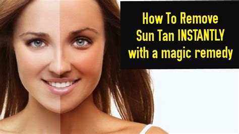 how to lighten tanned skin.